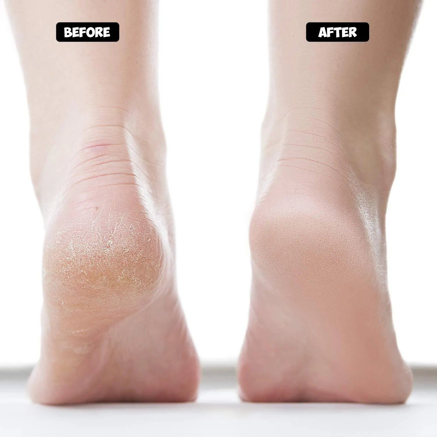 Gel Heel Socks